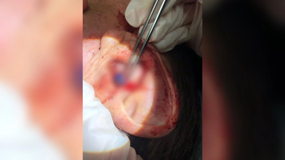 Обложка © Telegram / Первая Градская больница