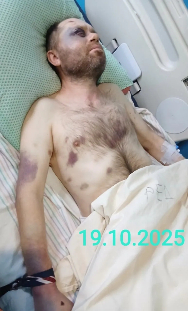 Избитый после посещения ТЦК украинец. Фото © Facebook (соцсеть запрещена в РФ; принадлежит корпорации Meta, которая признана в РФ экстремистской) / Віра Каленська
