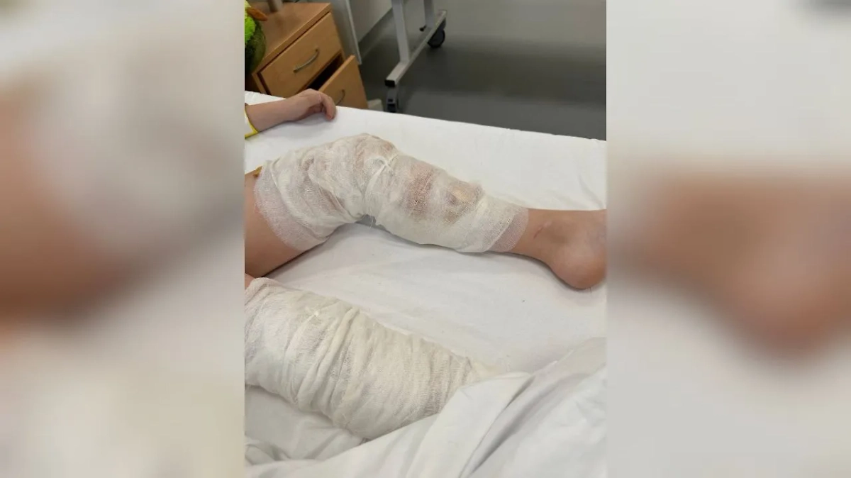 Богдану, пострадавшему при атаке БПЛА в Красногорске, предстоит операция. Видео © Telegram / Мишонова