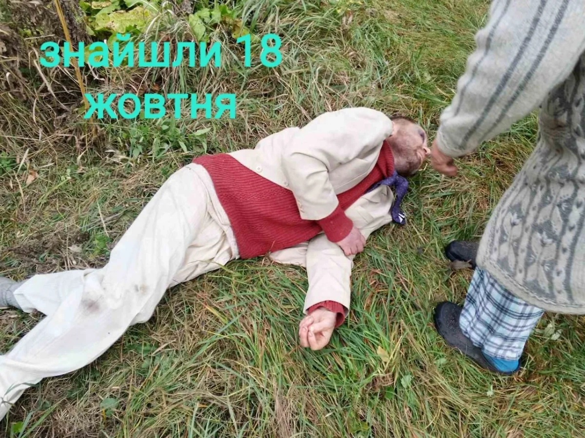 Избитый после посещения ТЦК украинец. Фото © Facebook (соцсеть запрещена в РФ; принадлежит корпорации Meta, которая признана в РФ экстремистской) / Віра Каленська