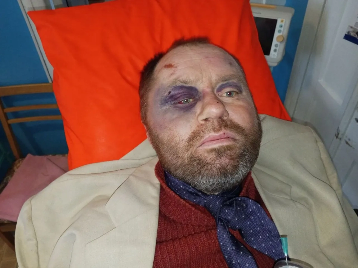 Избитый после посещения ТЦК украинец. Фото © Facebook (соцсеть запрещена в РФ; принадлежит корпорации Meta, которая признана в РФ экстремистской) / Віра Каленська