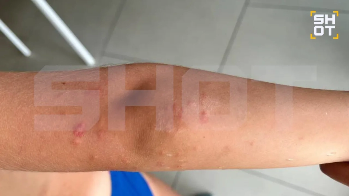 Таинственный планктон терроризирует российских туристов на тайских курортах. Фото © SHOT