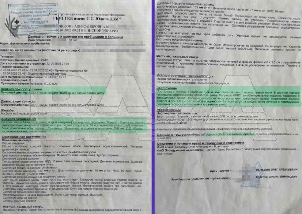 Жительница Подмосковья потеряла фалангу пальца после операции в частной клинике. Фото © Telegram / Baza