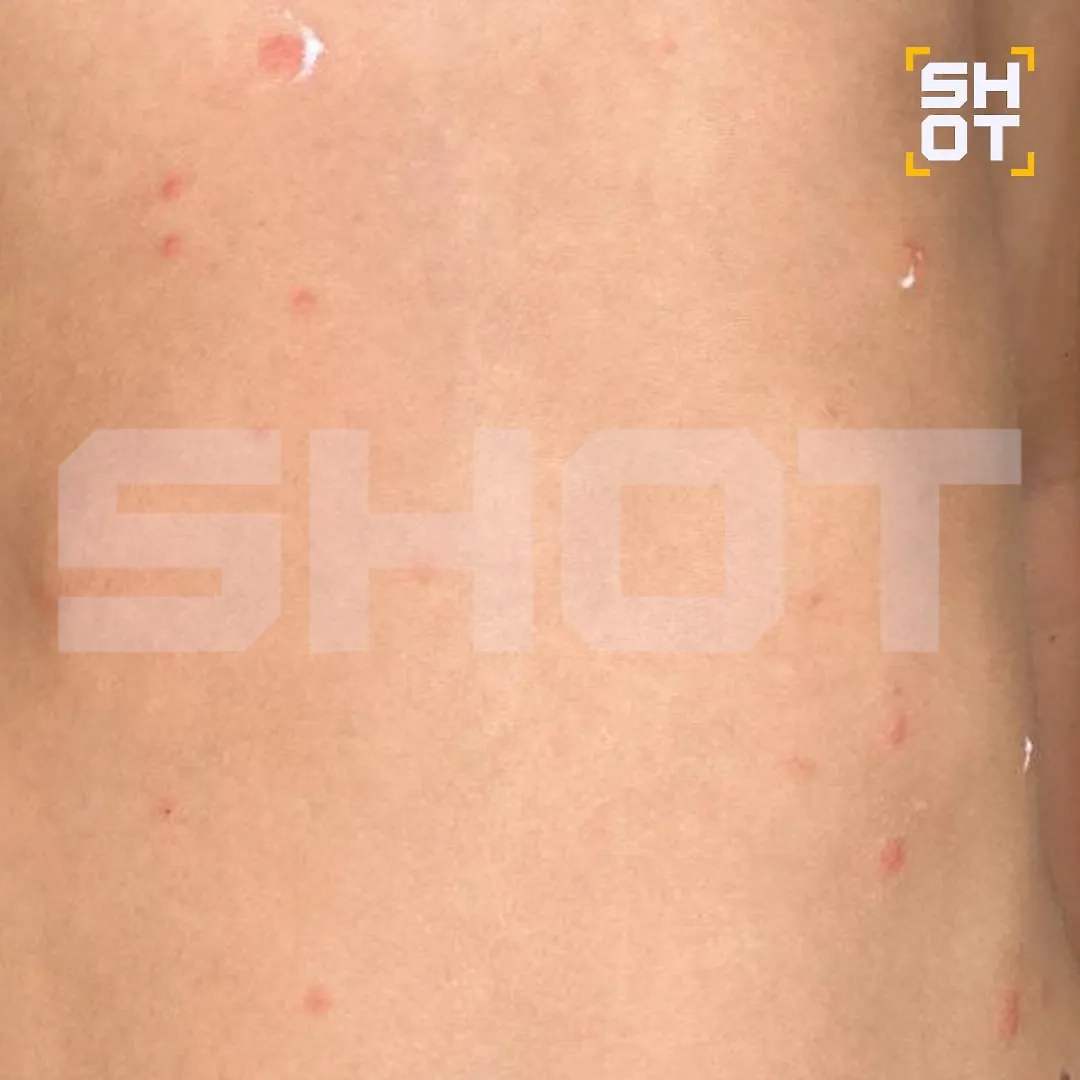 Таинственный планктон терроризирует российских туристов на тайских курортах. Фото © SHOT