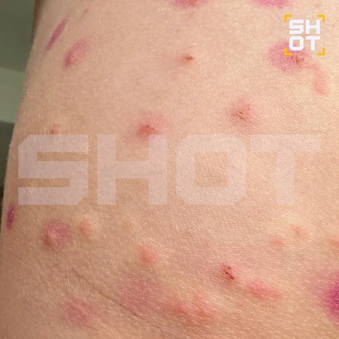 Таинственный планктон терроризирует российских туристов на тайских курортах. Фото © SHOT