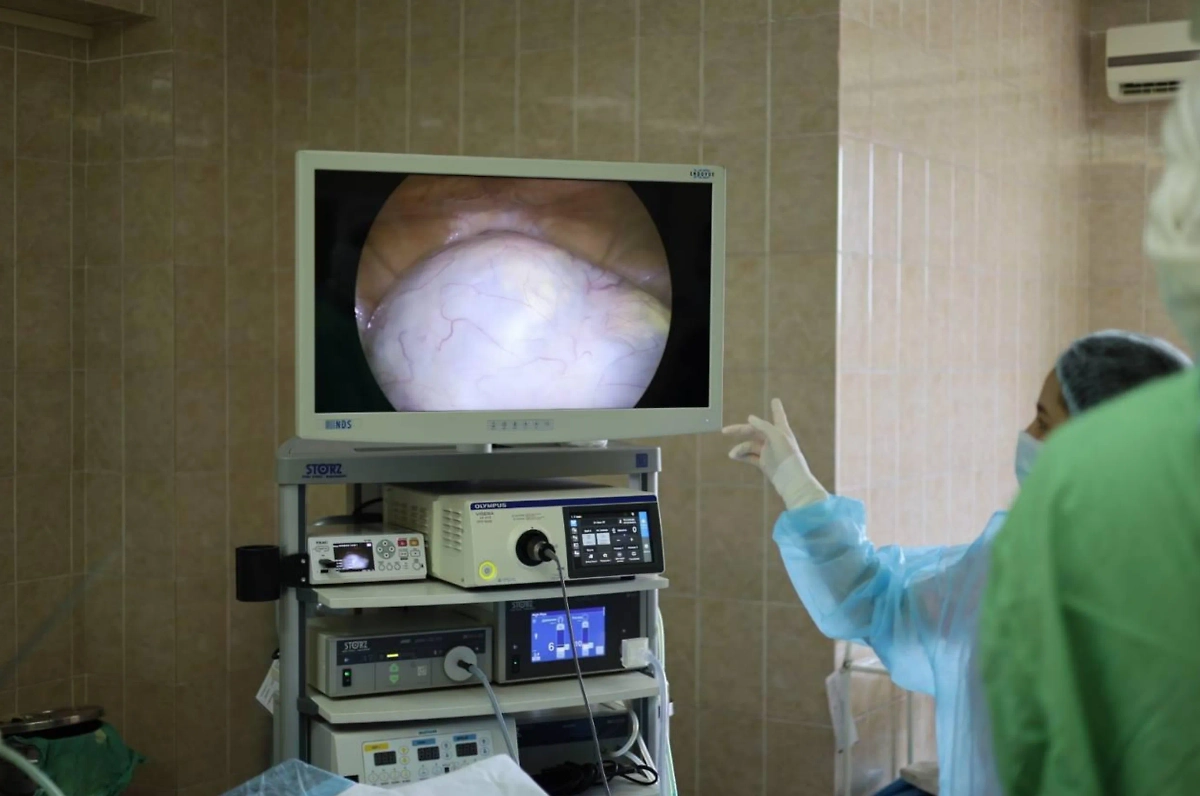 Диаметр кисты составлял около 20 см. Фото © Предоставлено Life.ru пресс-службой Министерства здравоохранения РФ