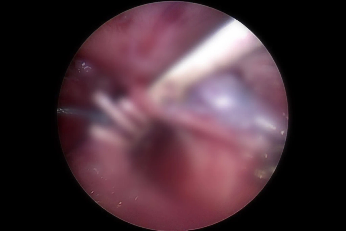 В МОЦОМД прооперировали ребёнка с уникальным свищом. Фото © Минздрав Московской области