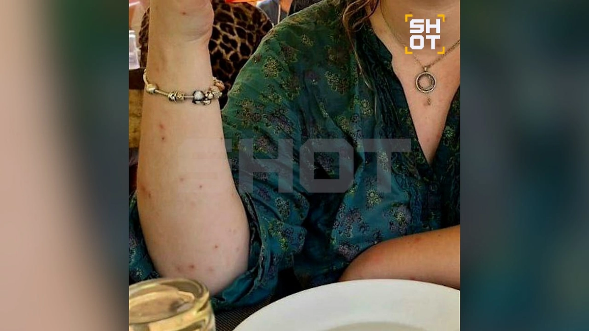 SHOT: Москиты проснулись на Кубе после урагана, туристов мучает зуд и бессонница