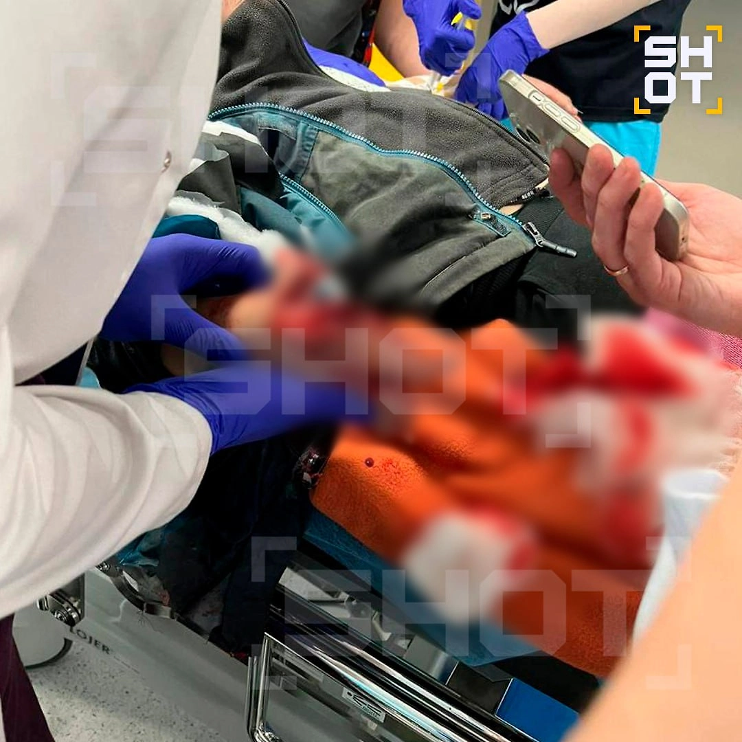 Ребёнку разорвало кисть при попытке взять деньги на площадке в Красногорске. Видео © Telegram / SHOT 