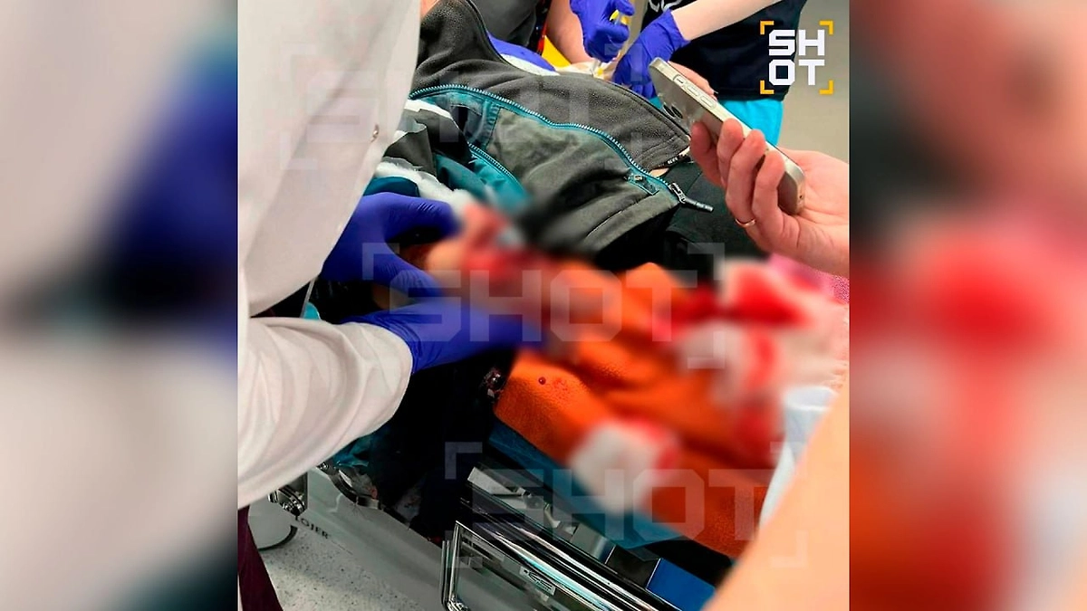 Ребёнку разорвало кисть при попытке взять деньги на площадке в Красногорске. Фото © Telegram / SHOT