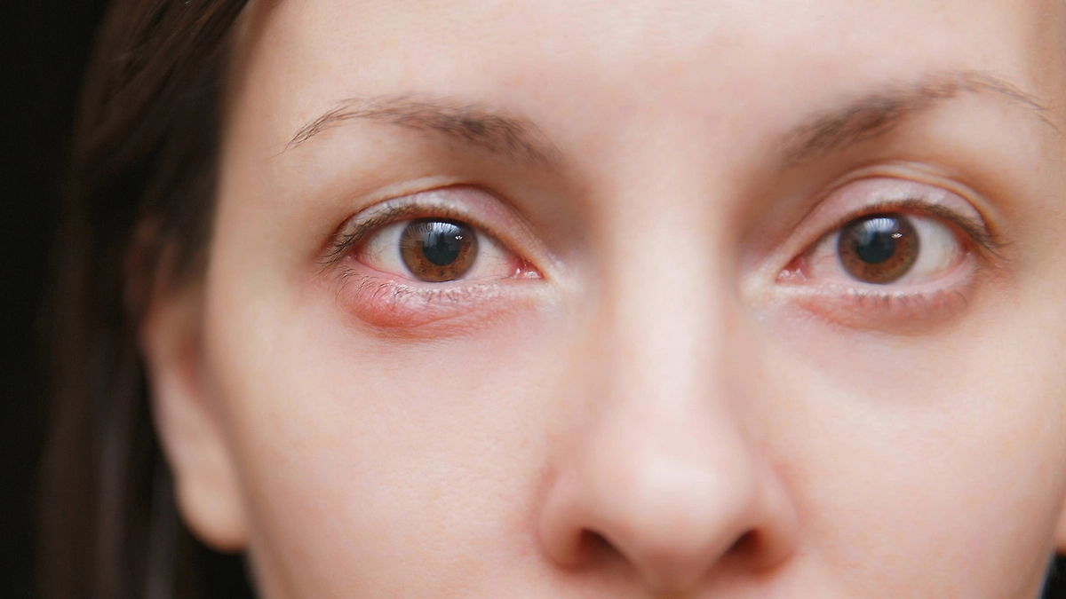 Карие глаза доминируют. То есть, гены, отвечающие за вашу кареглазость, являются доминантными. Фото © Shutterstock / FOTODOM / ViDI Studio