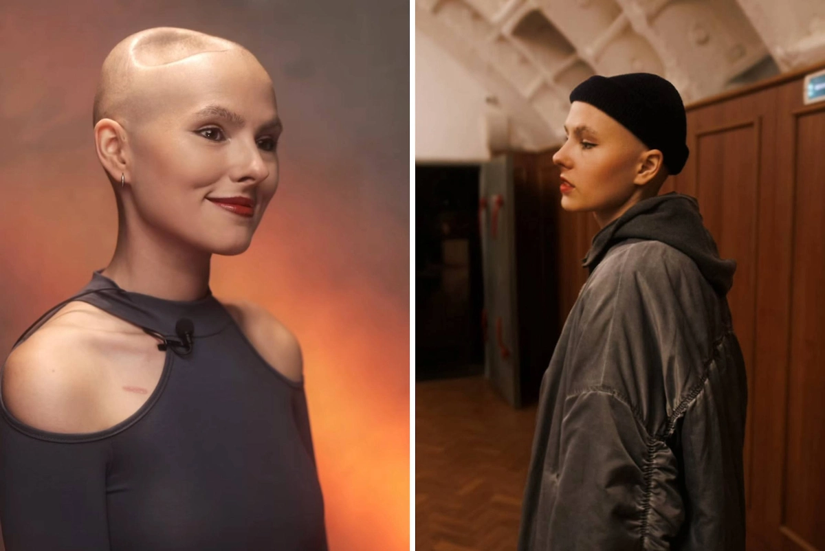 Ира Небога не скрывала своей болезни. Фото © Instagram (признан экстремистской организацией и запрещён на территории Российской Федерации) / neneboga