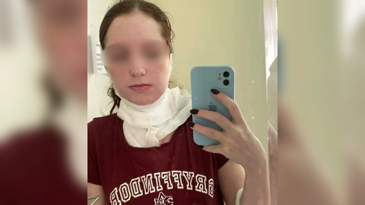 Жительница Подмосковья оказалась в реанимации после удаления зуба в частной клинике