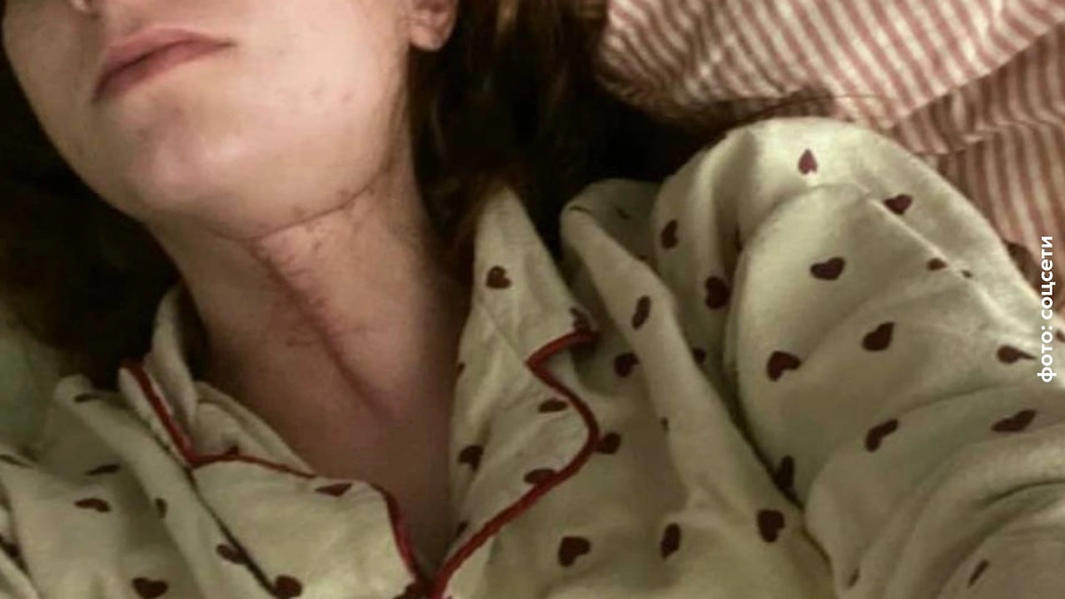 Жительница Подмосковья оказалась в реанимации после удаления зуба в частной клинике