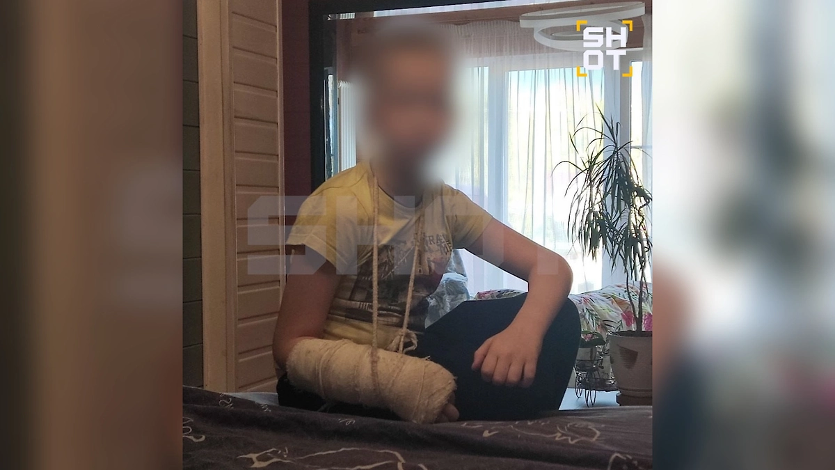 Архивное фото сына богородского маньяка с переломом руки неизвестного происхождения. Фото © Telegram / SHOT