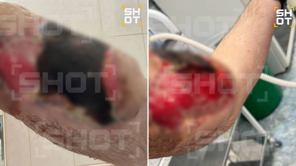 «Рукам-Базукам» грозит скорая ампутация из-за плохих анализов