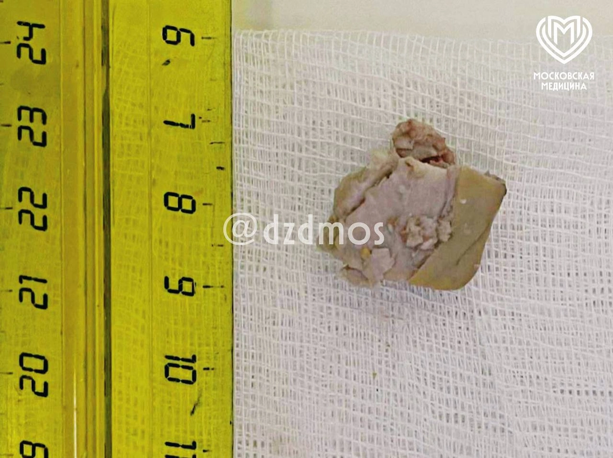 Фото © Telegram-канал «Московская медицина»