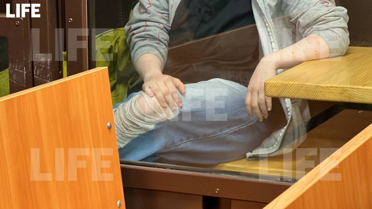 Участница истязания подростков в рехабе появилась на заседании суда с красными отметинами на коже. Фото © Life.ru