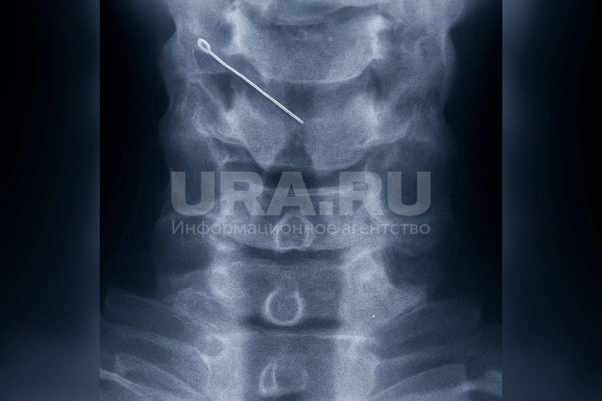 Рентген. Фото © Telegram / URA.RU