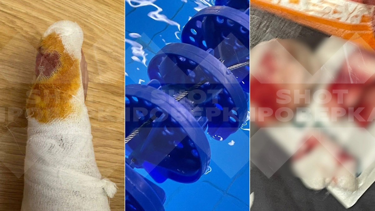 Москвич вспорол ногу на острых тросах бассейна премиального клуба XFIT. Фото © Telegram / SHOT ПРОВЕРКА