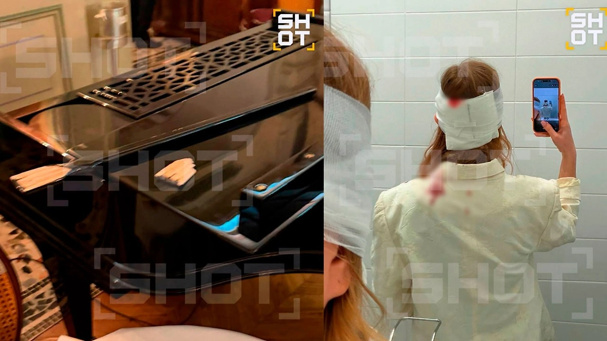 Травма девушки. Фото © Telegram / SHOT