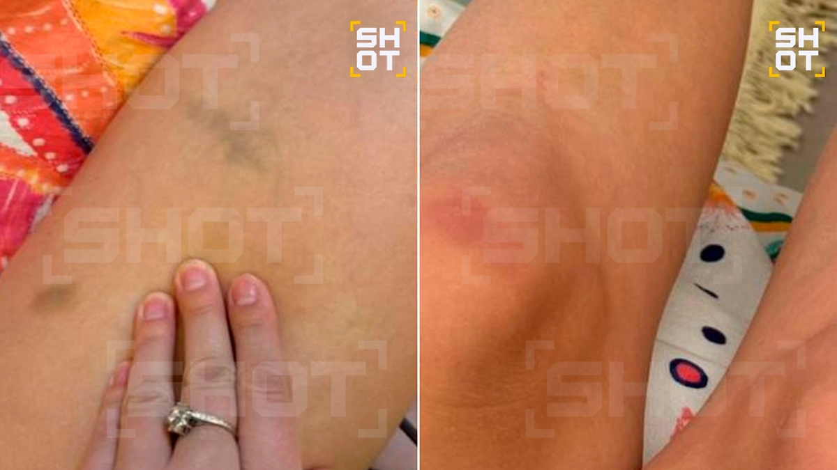 Туристка даже зафиксировала побои. Фото © Telegram / SHOT