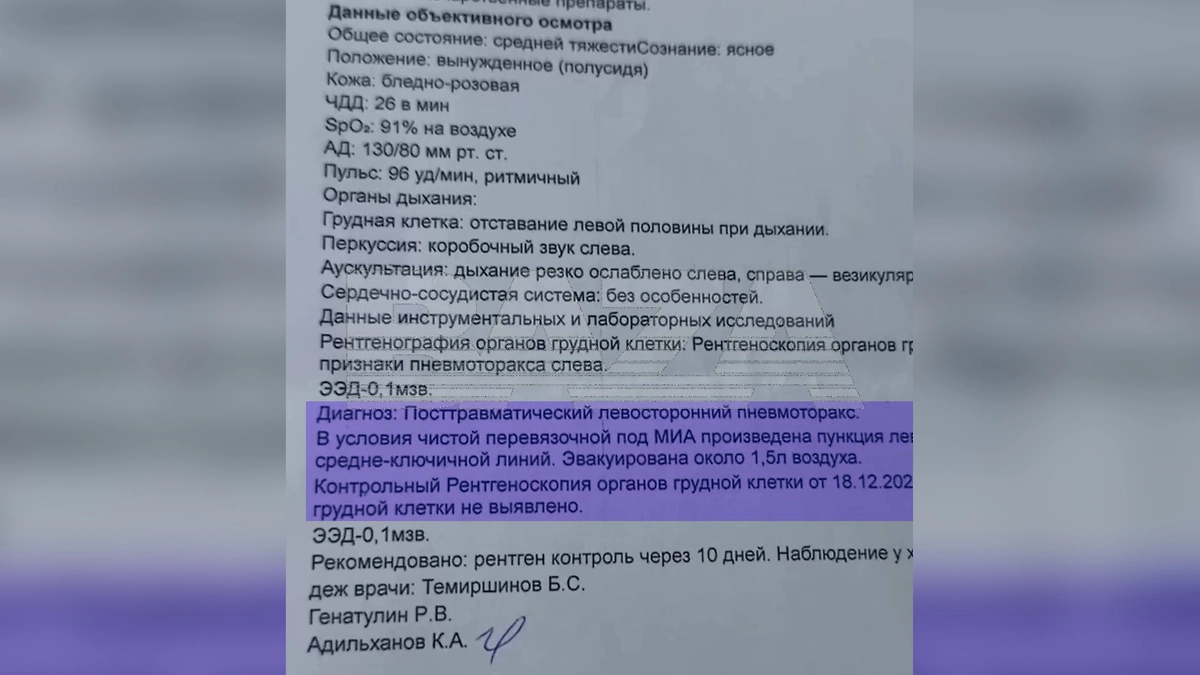 Жительнице Казахстана проткнули лёгкое во время иглоукалывания. Фото © Telegram / Baza