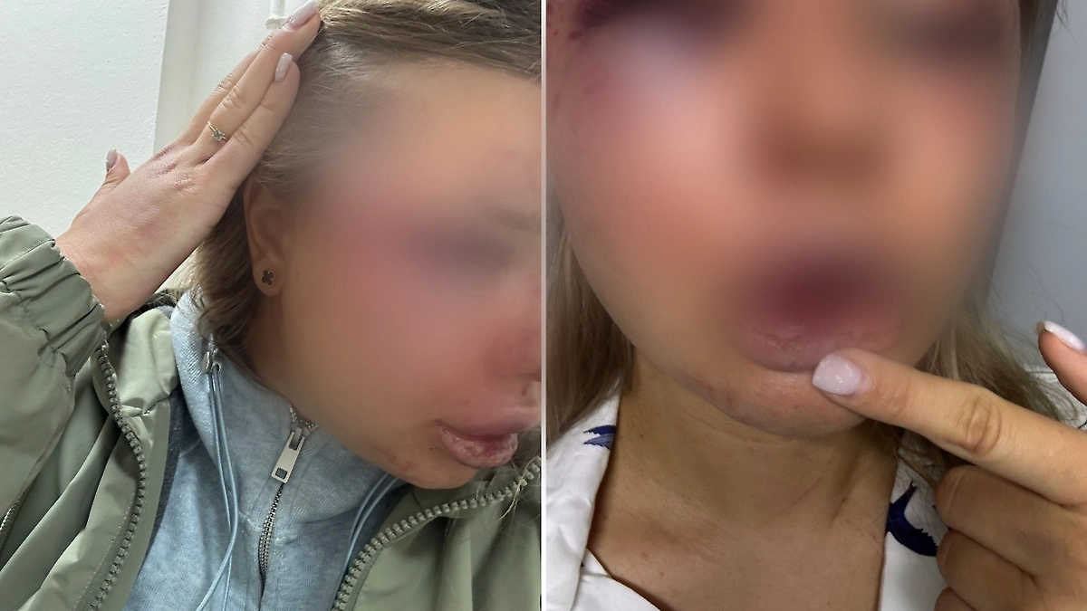 Обложка © Telegram / Новости Твери и Области