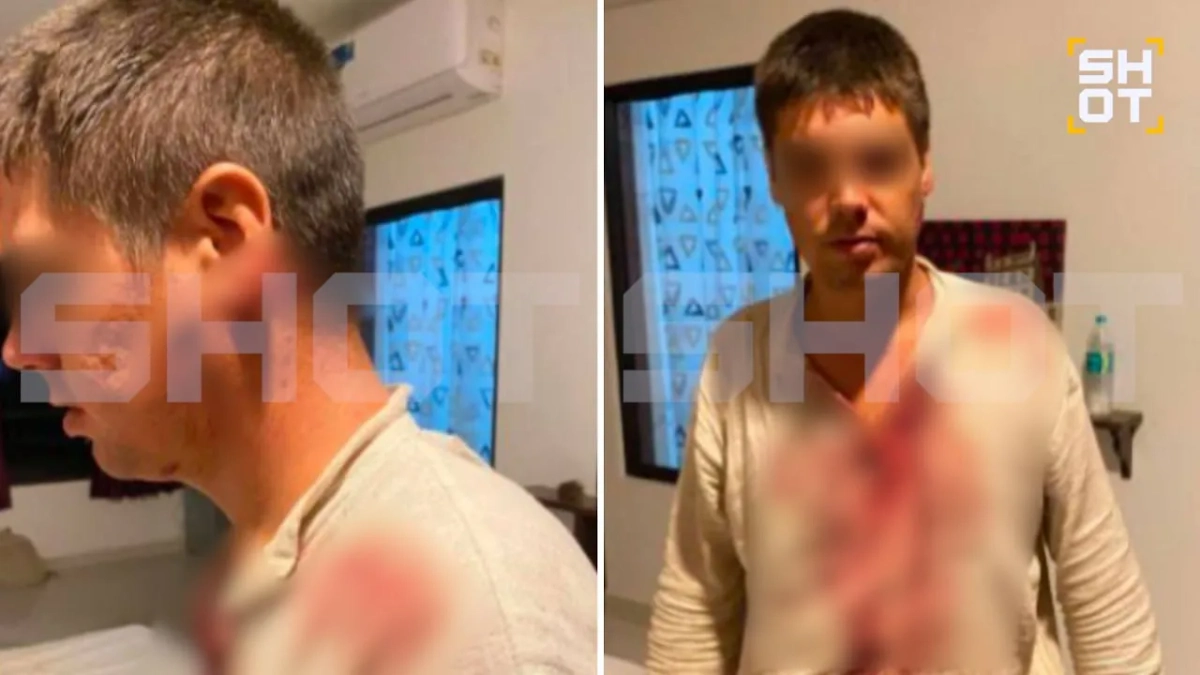 В Индии двое неизвестных с мачете напали на российских туристов. Фото © Telegram / SHOT