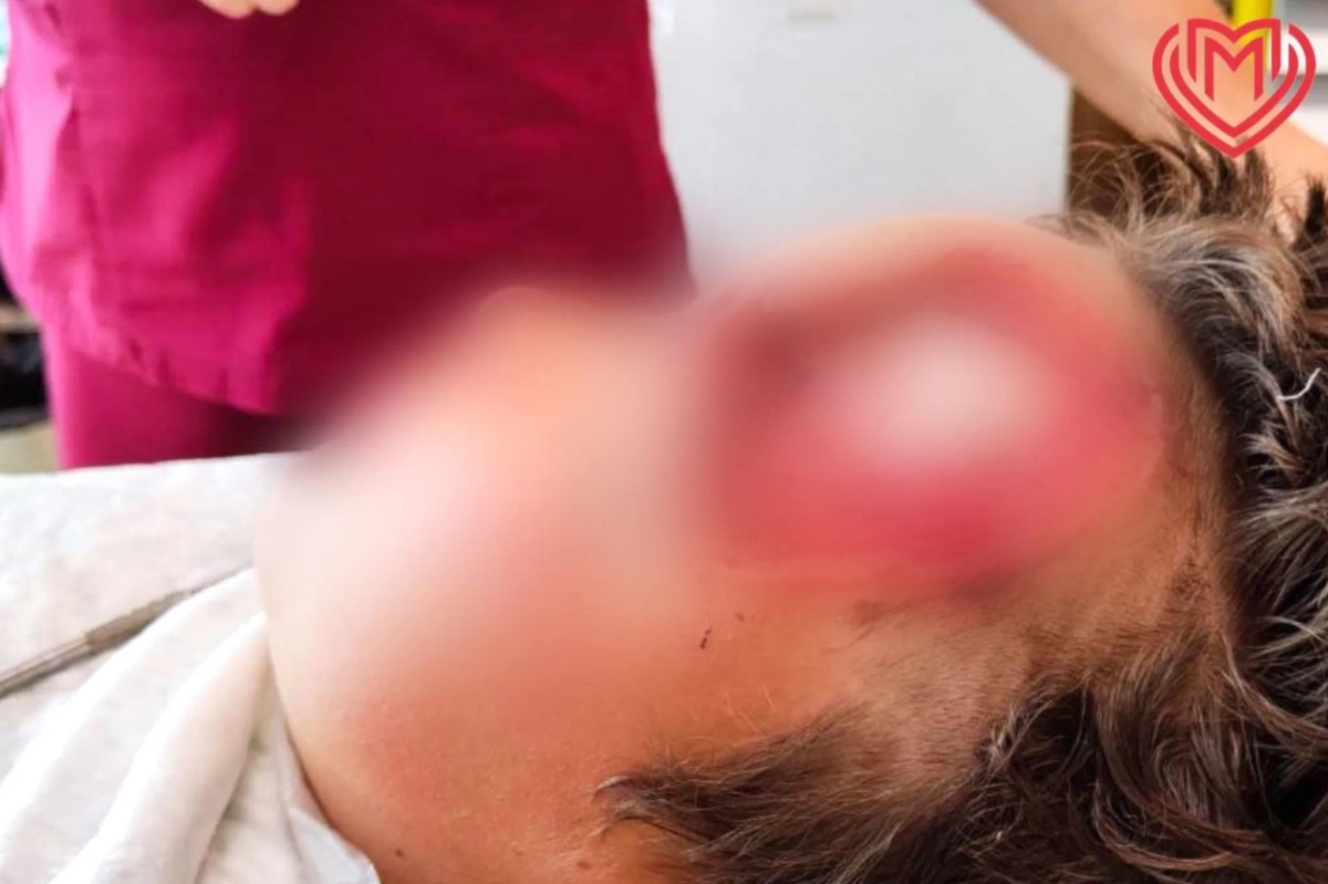 Собака напала на 10-летнего ребёнка и откусила ему лоб. Обложка © Департамент здравоохранения Москвы / Life.ru