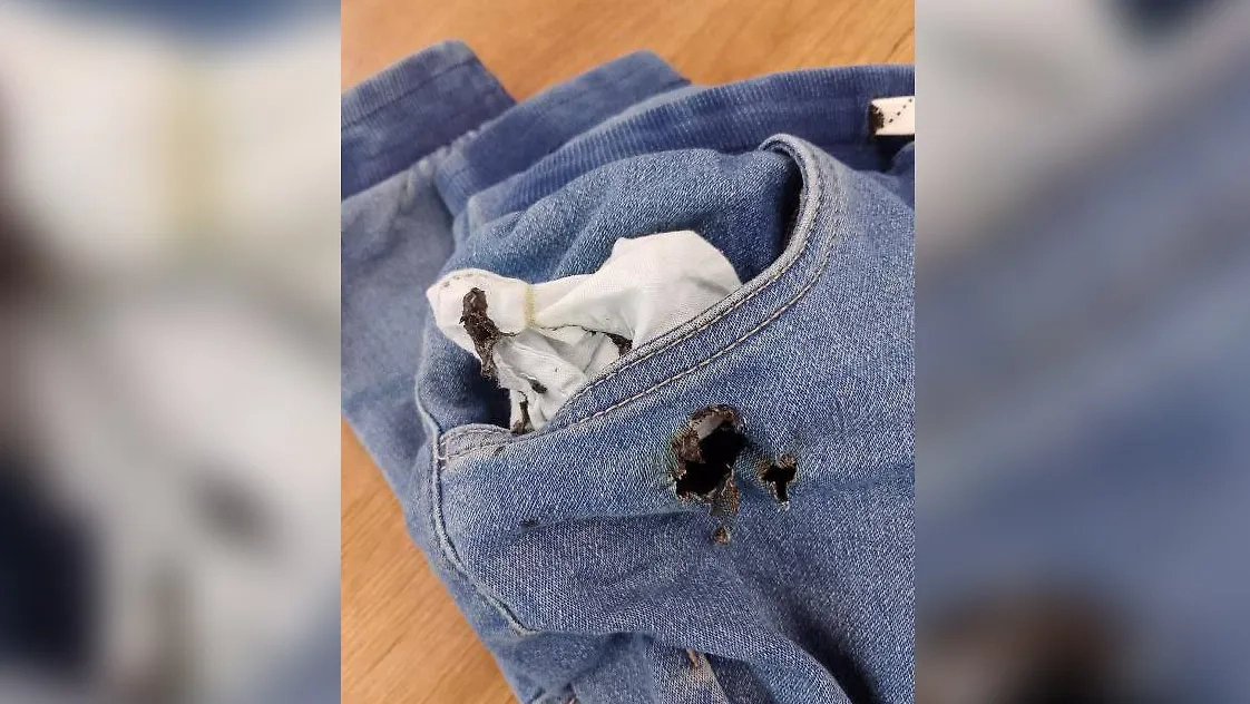 Телефон школьника загорелся прямо в кармане его джинсов. Обложка © Telegram / МЧС России