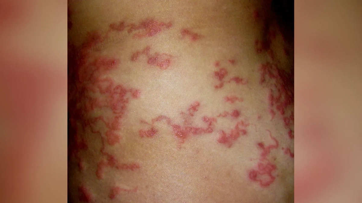 Мигрирующая личинка. Фото © Wikipedia / WeisSagung