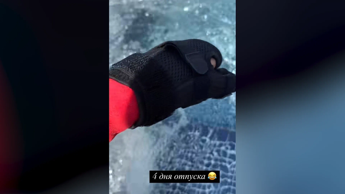 Лангета Кудрявцевой. Фото © Instagram (признан экстремистской организацией и запрещён на территории Российской Федерации) / @leratv