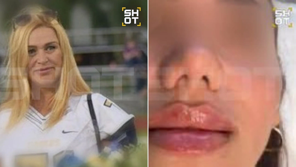 Косметолог из РФ (слева). Коллаж © SHOT