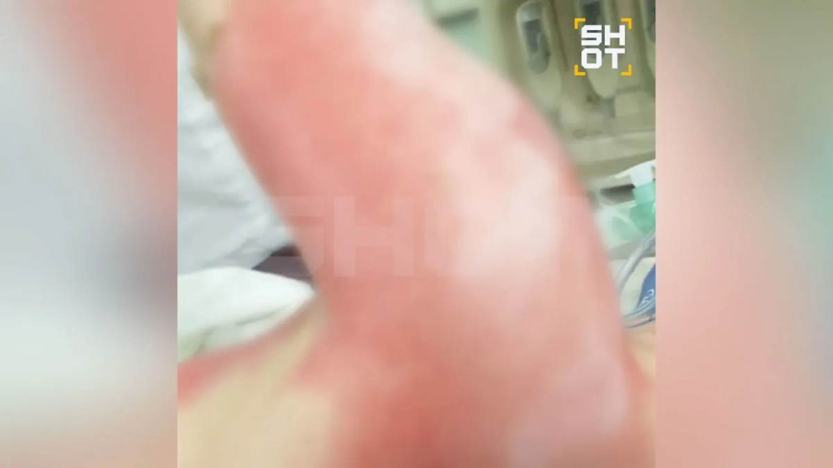 Московский школьник получил ожог от зарядки для смартфона. Фото © SHOT