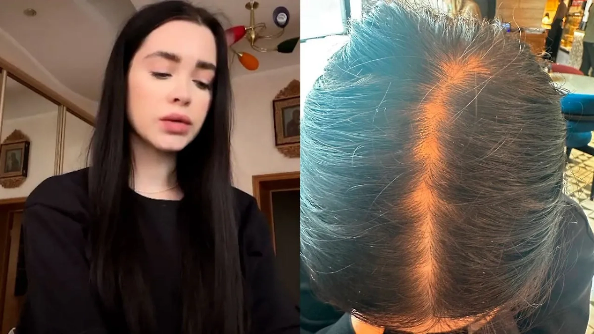 Россиянка хотела улучшить состояние волос в клинике, но получила заражение крови и лысины. Обложка © SHOT