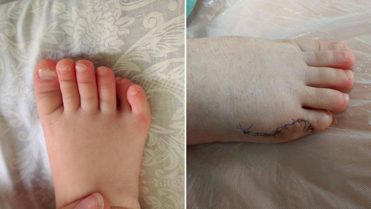 До / После. Фото © Предоставлено Life.ru