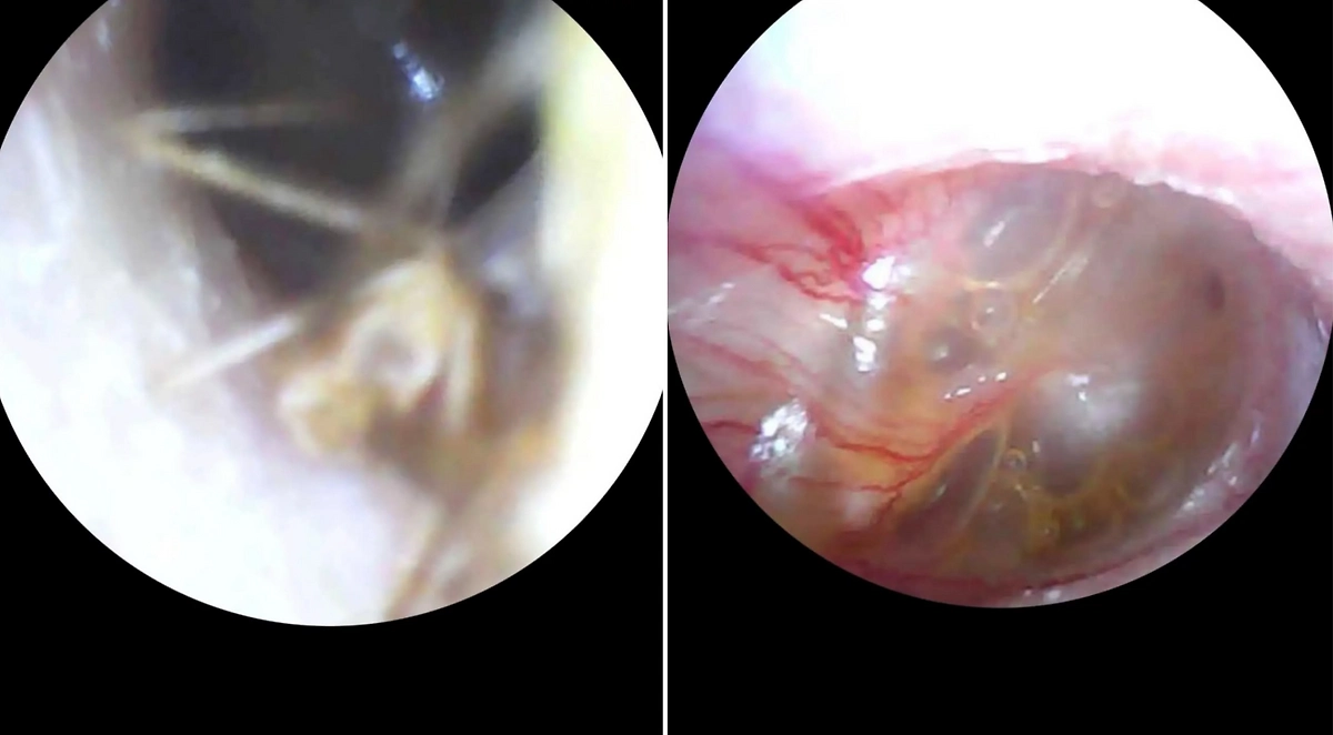 Фото © Facebook (Соцсеть запрещена в РФ; принадлежит корпорации Meta, которая признана в РФ экстремистской) / КНП "Центральна міська клінічна лікарня Івано-Франківської міської ради"