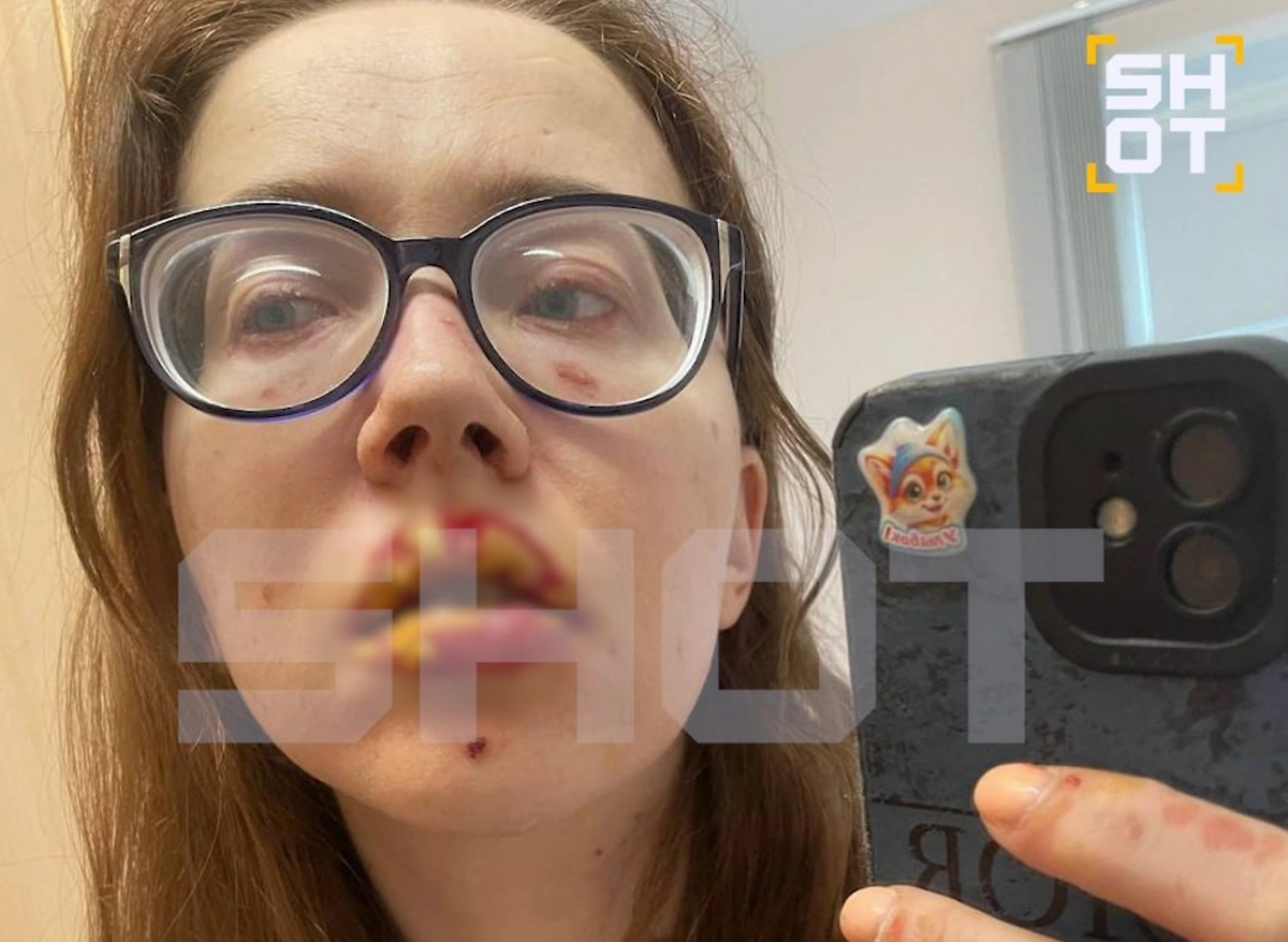 Россиянка едва не умерла от таблеток от мигрени. Фото © SHOT