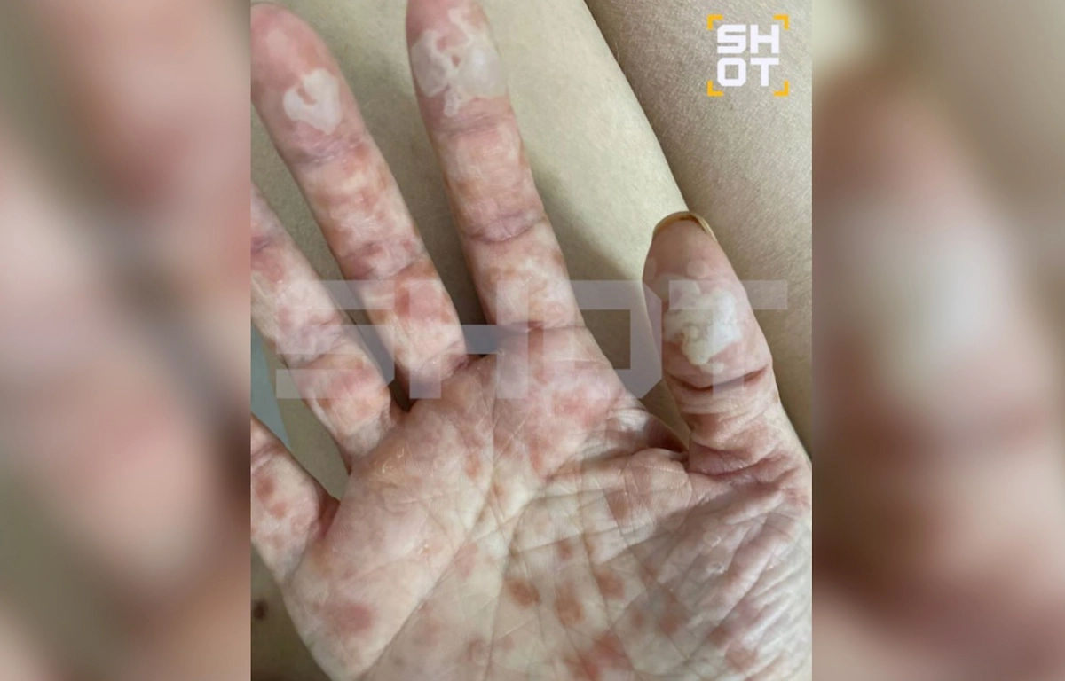 Россиянка едва не умерла от таблеток от мигрени. Фото © SHOT