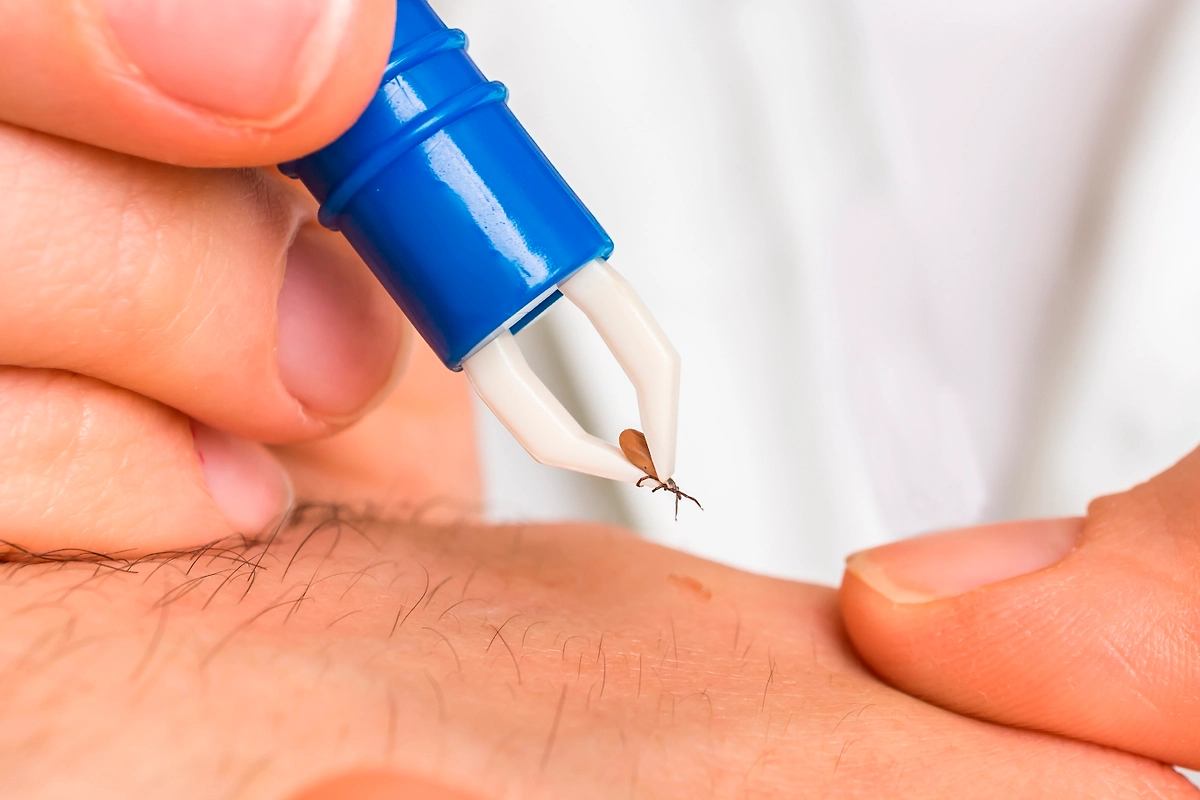 Что делать при укусе клеща — памятка: пошаговая инструкция и куда обращаться. Фото © Shutterstock / FOTODOM / andriano.cz