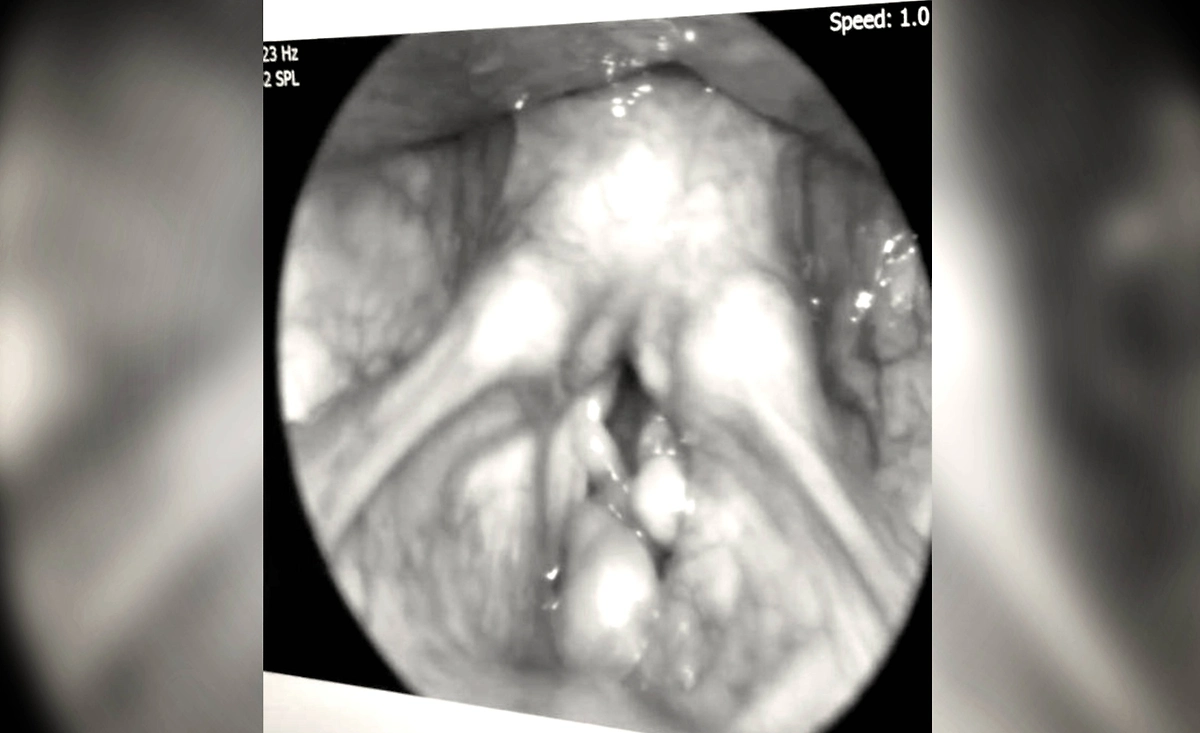Москвич «заработал» опухоль из-за сигарет. Фото © Telegram / Baza