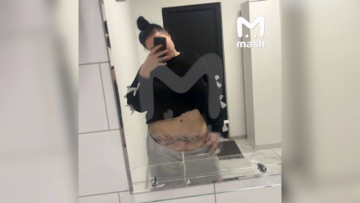 Пациентки обвинили томскую клинику «Генелли» в изуродовании более десяти женщин. Фото © Telegram / Mash