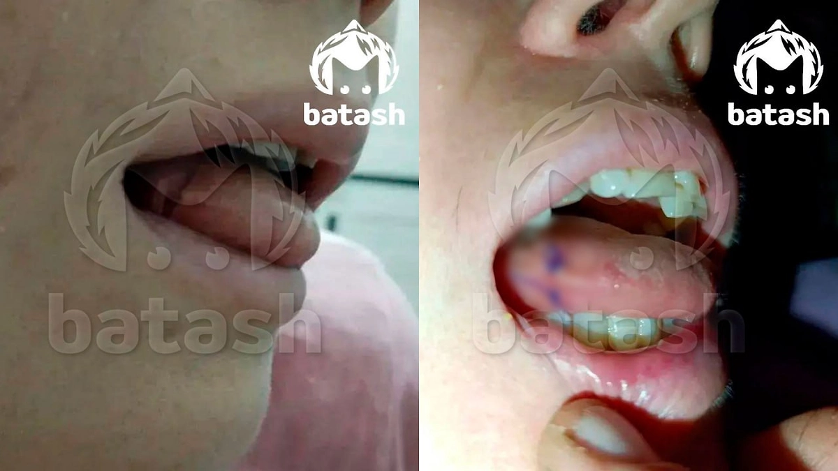 Фото © Telegram / Mash Batash