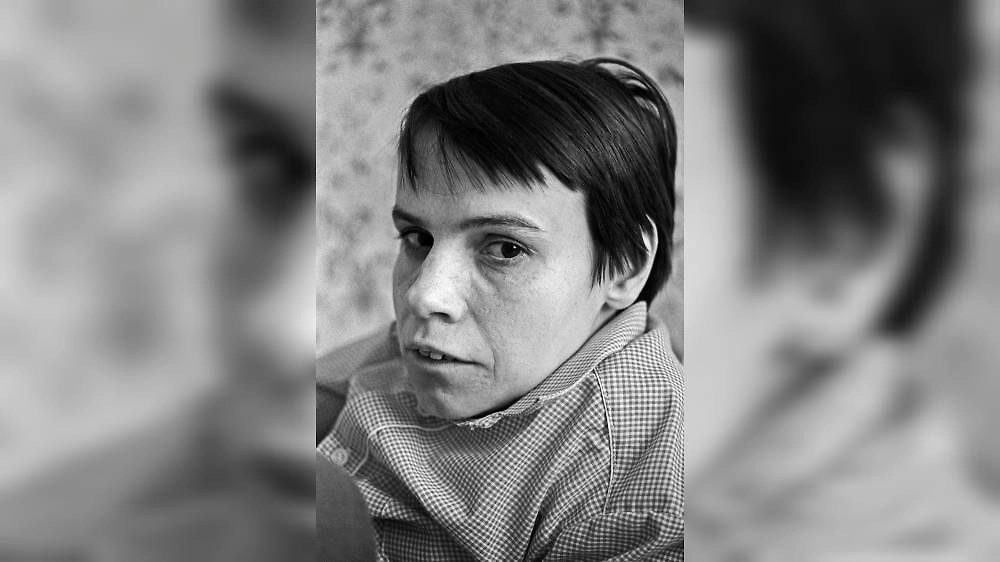 Как и почему скончались первые сиамские близнецы СССР? Судьба Маши и Даши Кривошляповых. Фото © ТАСС / Фотохроника ТАСС / Олег Власов