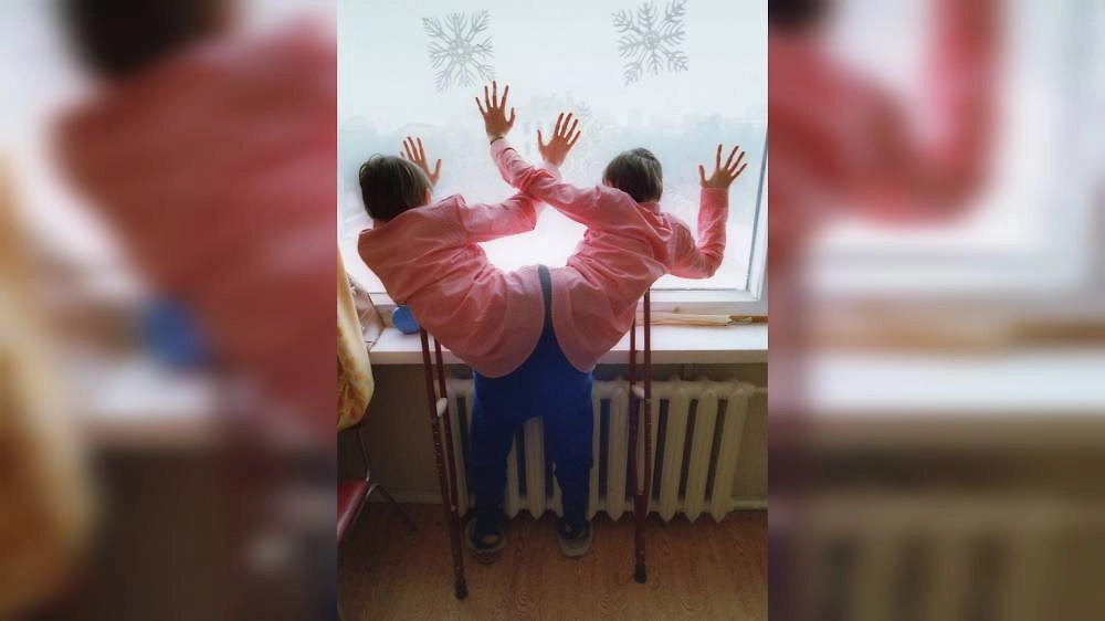 Первые сиамские близнецы СССР: Маша и Даша Кривошляповы. Фото © ТАСС / Фотохроника ТАСС / Олег Власов