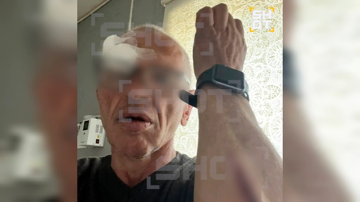 56-летний мужчина, пострадавший от рук Павла. Фото © SHOT