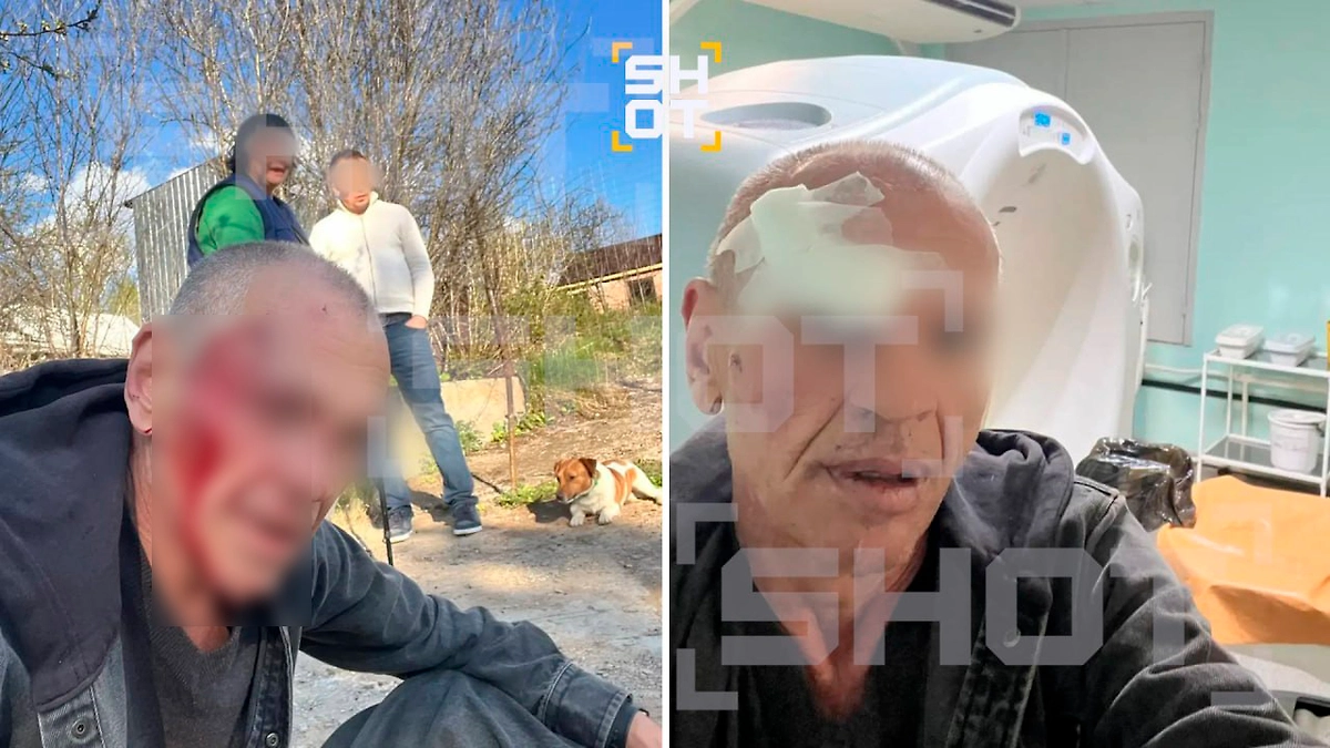 56-летний мужчина, пострадавший от рук Павла. Фото © SHOT