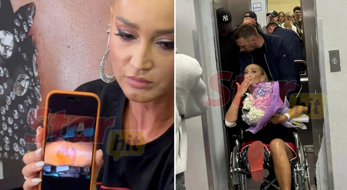 Ольга Бузова впервые показала ногу с 40 швами после операции. Фото © Телеграм / StarHit