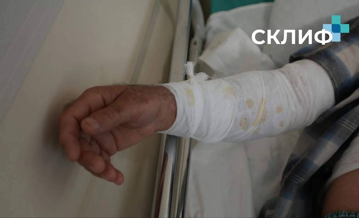 Столичные врачи спасли двух москвичей, один из которых пытался приобрести иммунитет к яду гадюки, а другой верил в целебные свойства борщевика. Фото © Telegram /Склиф